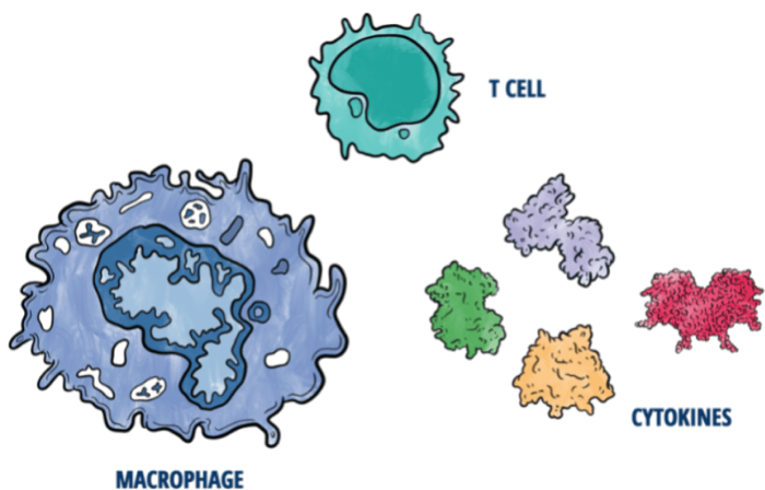 Hemophagocytic lymphohistiocytosis (HLH) is a hyperinflammatory syndrome of uncontrolled immune activity resulting in life-threatening organ damage